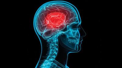 Although they may be ‘invisible’ injuries, concussions can cause serious problems.