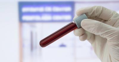 A new blood test to diagnose Alzheimer’s Disease is being developed. (Photo via X.) A new blood test to diagnose Alzheimer’s Disease is being developed. (Photo via X.)