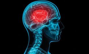 Although they may be ‘invisible’ injuries, concussions can cause serious problems.